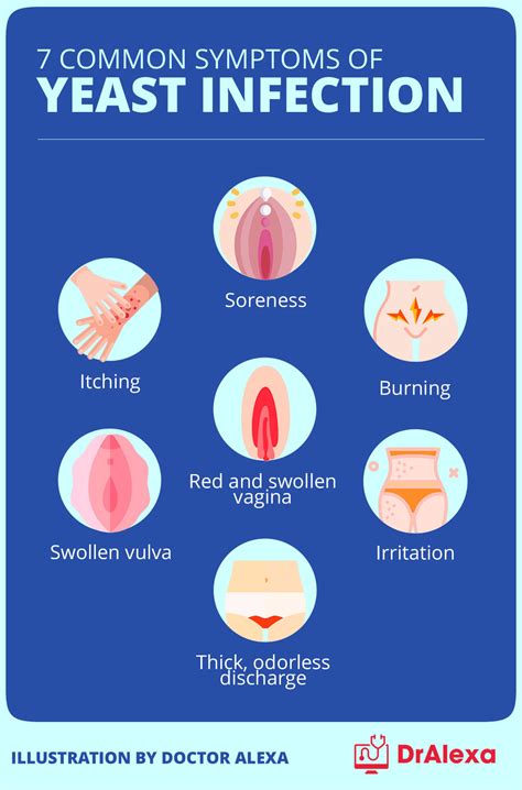 Can a yeast infection cause bumps? Symptoms of yeast infection (2022)