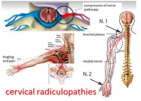 Median Nerve Neck