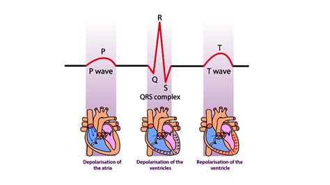 What is the relationship between the cardiac cycle and an ECG?