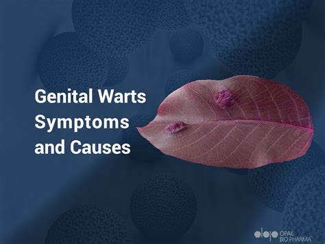 Symptoms Of Venereal Warts - Infoupdate.org