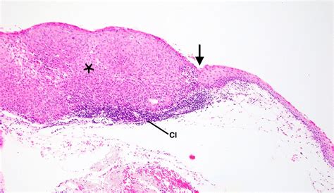 Conjunctiva Histology