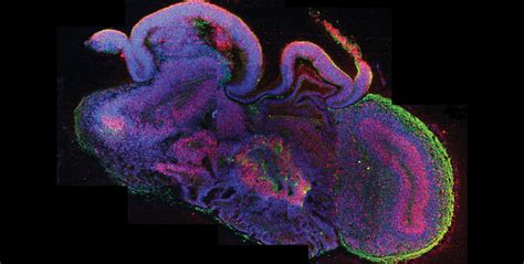 'Mini Brains' Built From Stem Cells - ABC News