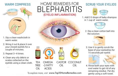 Seborrheic Blepharitis Treatment