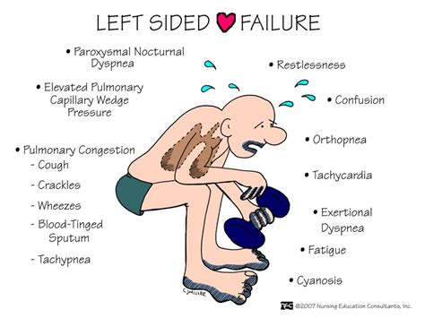 Left sided heart failure-ABC Medicine