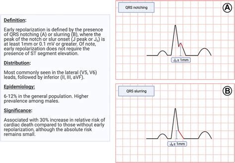 Definition, Epidemiology, and Significance of Early Repolarization ...