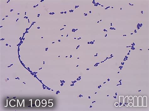 Bacillus Coagulans Gram Stain