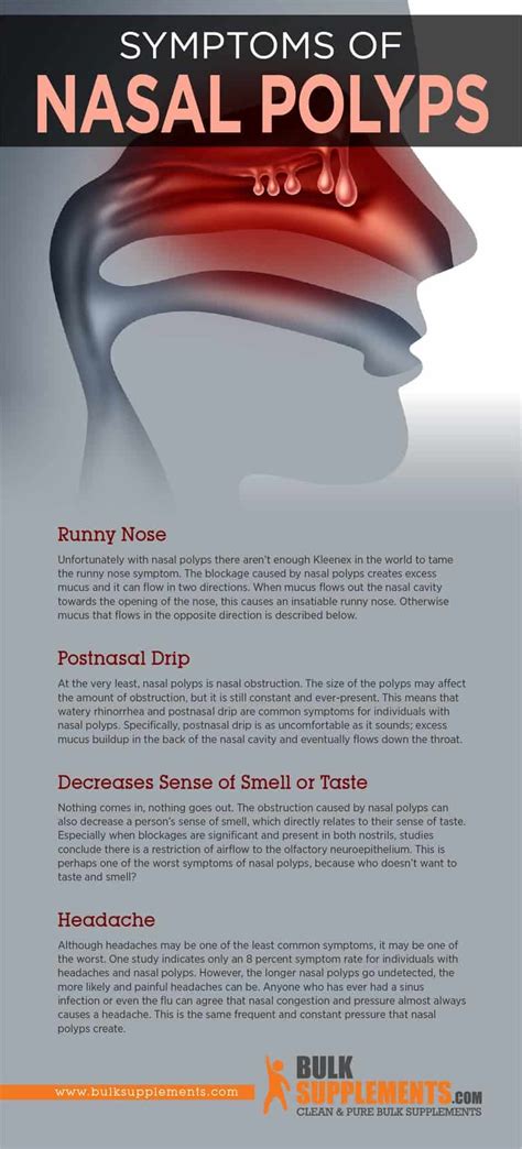 Nasal Polyps Anatomy