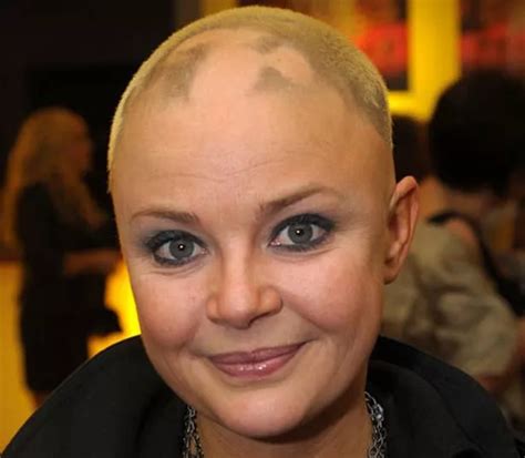 Alopecia sufferer Gail Porter has hair sprouting on her head again ...