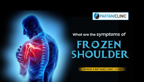 What are the symptoms of Frozen Shoulder? | Partani Clinic