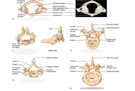 different types of vertebrae Diagram | Quizlet