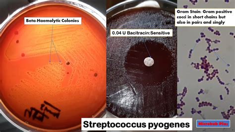 Streptococcus pyogenes colony morphology, Bacitracin Sensitivity ...