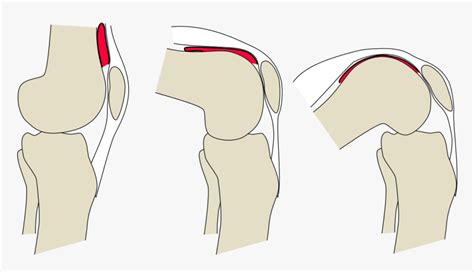 Articularis Genu Muscle Knee, HD Png Download - kindpng