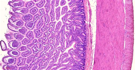 Human ileum cross-section histology slides, 7 µm sec., H&E Stain, human ...