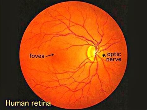 Basics Of Fundoscopy - Powerpoint Presentation - YouTube