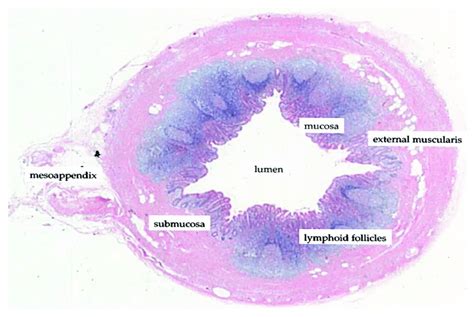 Histological transverse section of the vermiform appendix... | Download ...