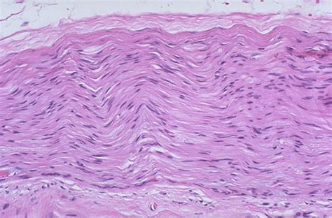 Peripheral Nerve Histology Nodes Of Ranvier