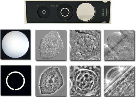 Phase-Contrast Microscopy