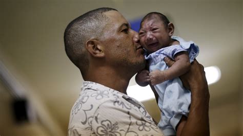 Caught Off Guard by Zika, Brazil Struggles With Deformed Babies