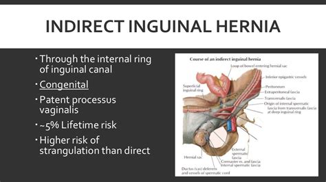 Inguinal Hernia - Pictures