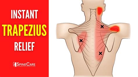 How to Relieve Trapezius Pain FOR GOOD - YouTube