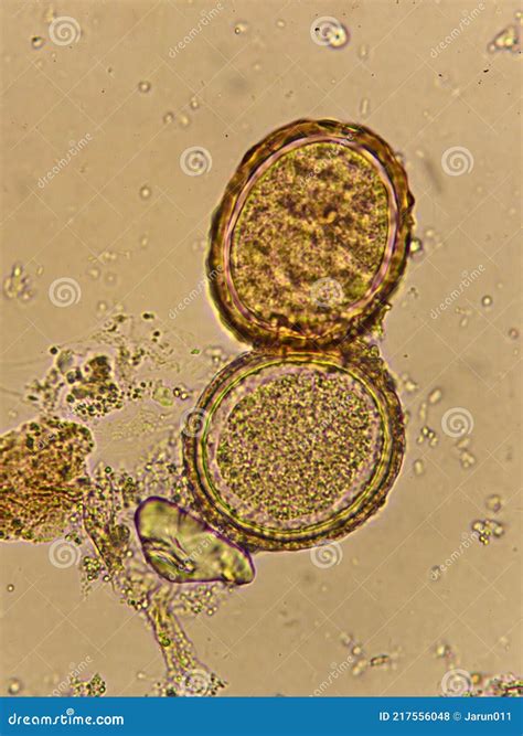 Egg of Ascaris Lumbricoides Roundworm in Human Stool Stock Photo ...