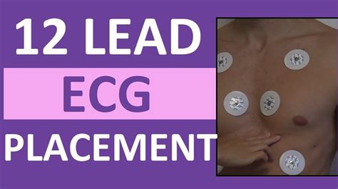 12 Lead Ecg Placement Mnemonic