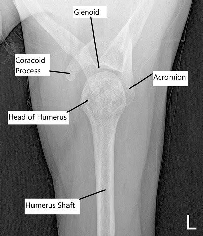 Shoulder Anatomy - Complete Orthopedics & Podiatry | Multiple NY Locations