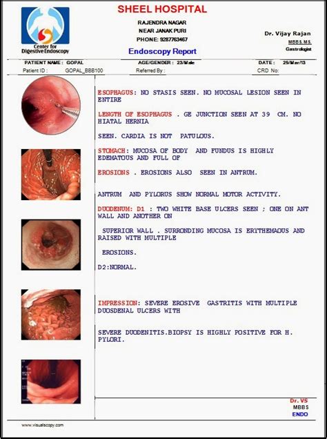 Endoscopy Software: Endoscopy Imaging Software