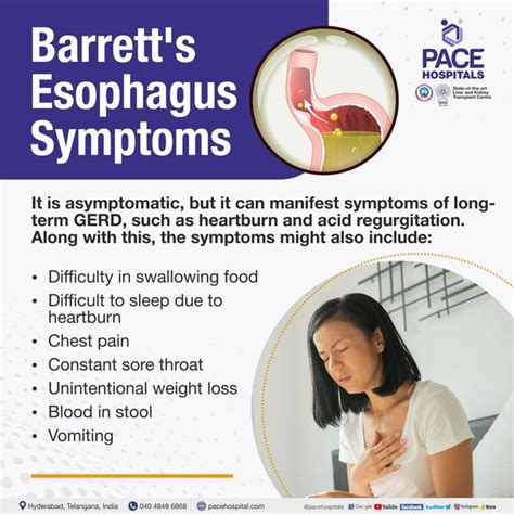 Barrett's Esophagus: Causes And Symptoms - Ask The Nurse Expert