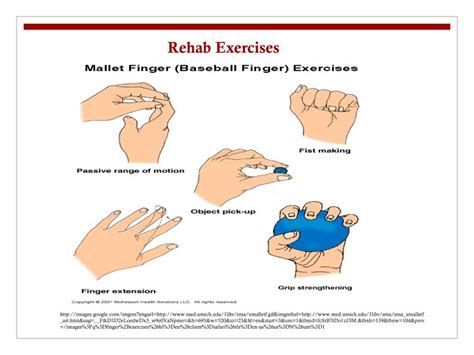 PPT - Phalange Injuries PowerPoint Presentation - ID:432645