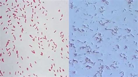 The post Pseudomonas Aeruginosa Under Microscope (Gram Staining ...