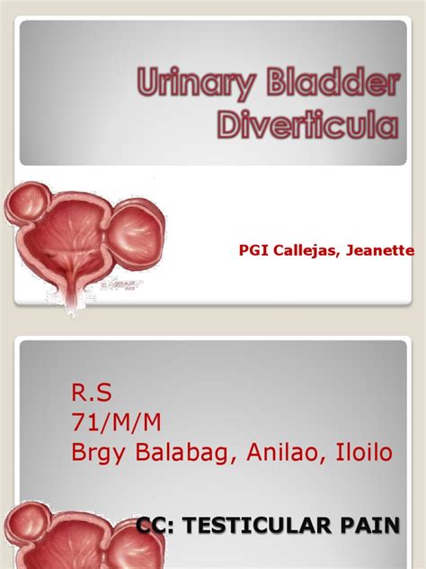 Bladder Diverticula | Urinary Tract Infection | Urinary Bladder | Free ...