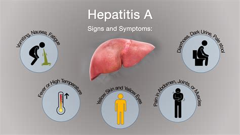 Hepatitis A: Symptoms, Causes, and Treatment - Scientific Animations