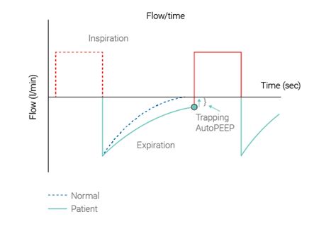 Measurement of AutoPEEP and total PEEP | Hamilton Medical