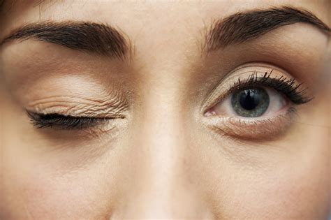 Why is My Eyelid Twitching? | UPMC HealthBeat