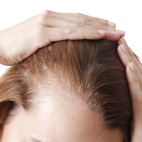 Causes Of Hair Loss In Women - Moore Unique Skin Care