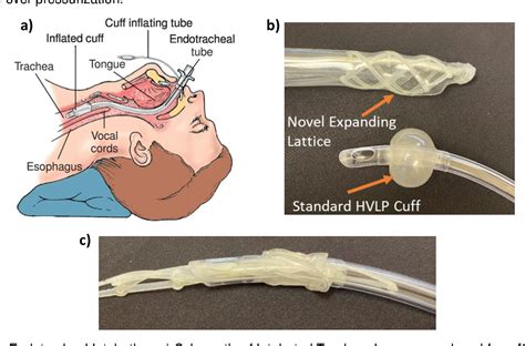 Figure 1 from Novel expandable architected breathing tube for improving ...