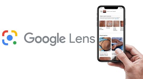 Google Lens now lets you identify skin conditions from images captured ...