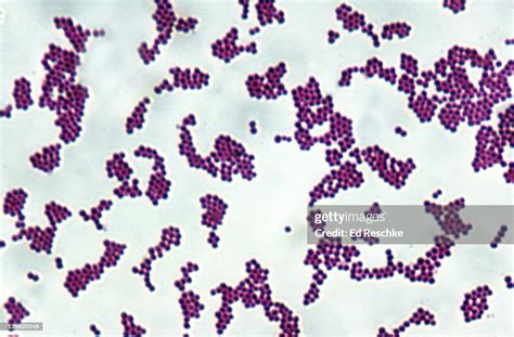 Staphylococcus Aureus Gram Positive Spherical Bacteria 500x At 35mm ...