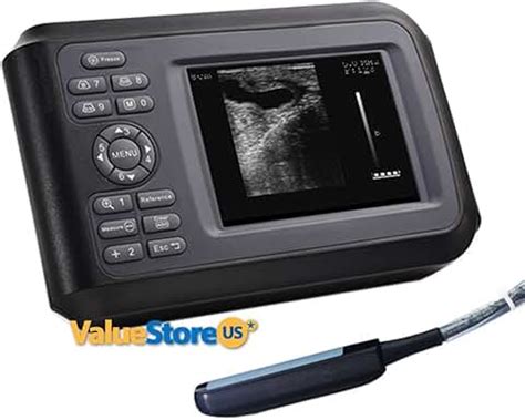 Amazon.com: portable ultrasound device