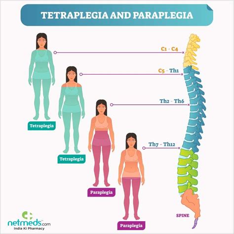 MEDICAL SCHOOL: paraplegia and tetraplegia,what to know? | Paraplegia ...