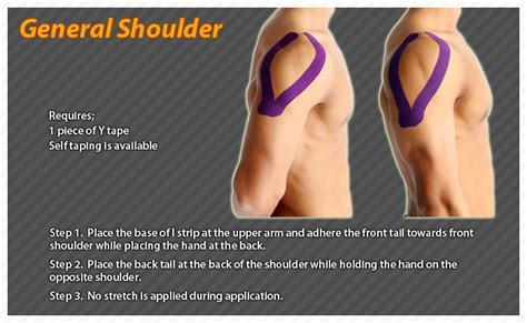 How to apply kinesiology taping for the shoulder rotator cuff oedema ...