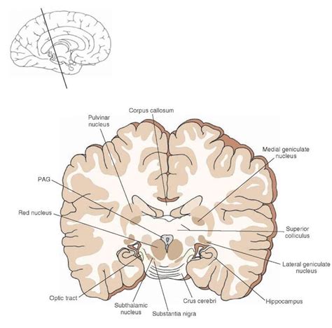 Cross section of the brain depicting the positions occupied by the ...