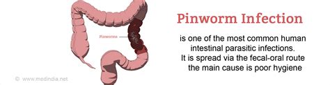 Pinworm | Thread worm Infection - Causes, Symptoms, Diagnosis ...