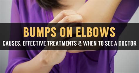 Itchy Bumps on Elbows Causes and Natural Treatment