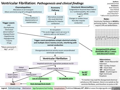 Ventricular Fibrillation: Pathogenesis and clinical findings | Calgary ...