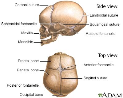 Fontanelles - bulging Information | Mount Sinai - New York