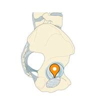 Transverse acetabular ligament - e-Anatomy - IMAIOS