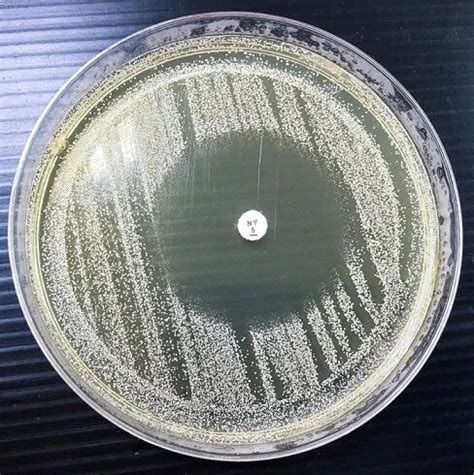 Mueller Hinton Agar -Its Composition, Uses, and Preparation