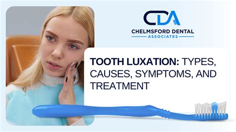 Tooth Luxation: Types, Causes, Symptoms, and Treatment